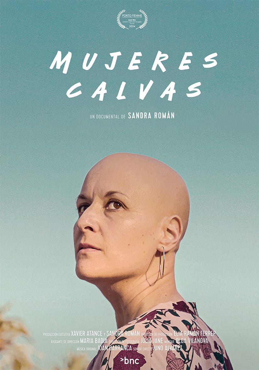 Mujeres calvas